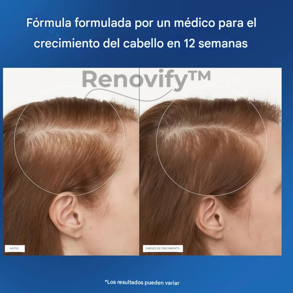 Serum Roll-On para el crecimiento y fortalecimiento capilar - Renovify
