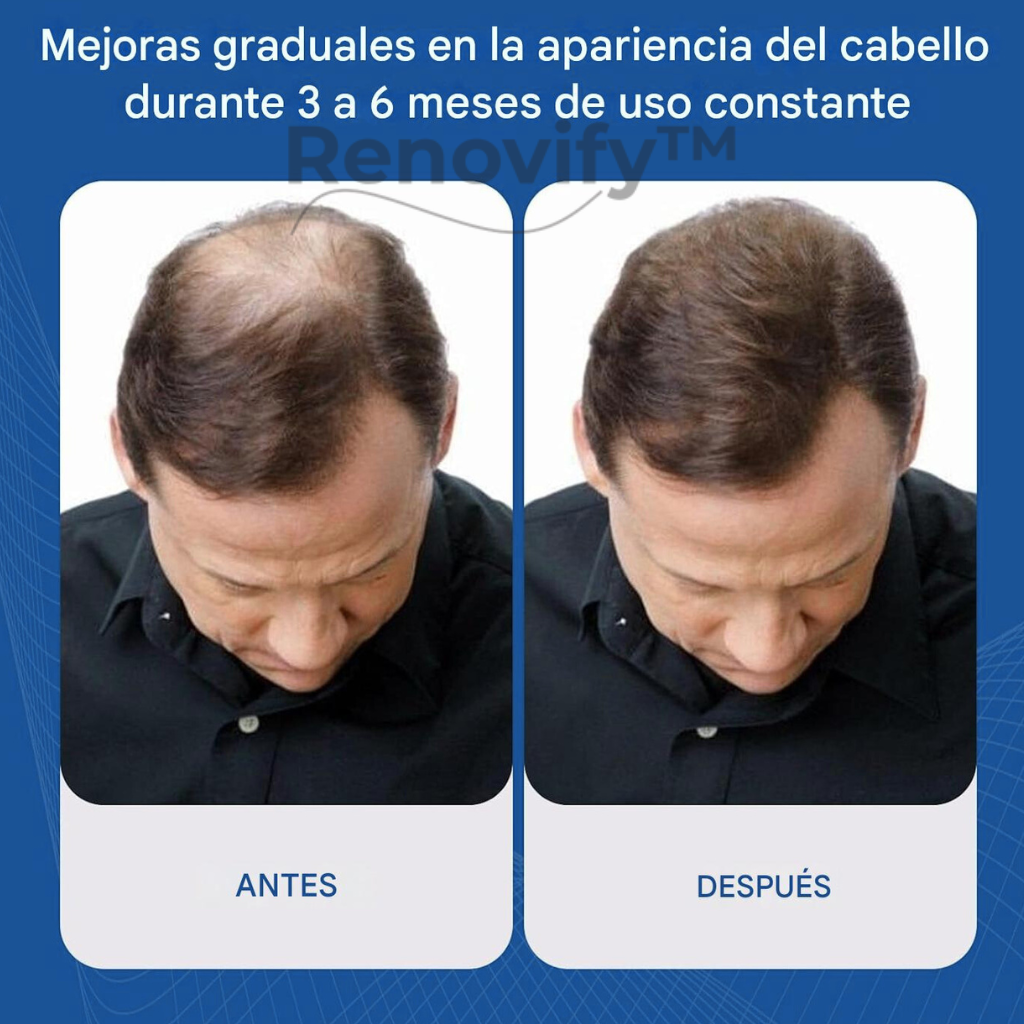 Serum Roll-On para el crecimiento y fortalecimiento capilar - Renovify